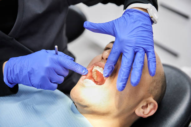 Best Dental Abscess Treatment in Paloma Creek South, TX